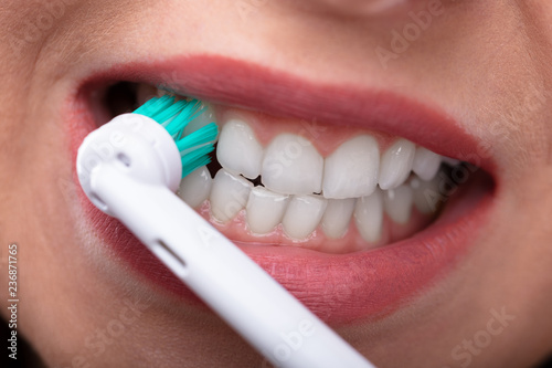 Woman Brushing Teeth With Electric Toothbrush