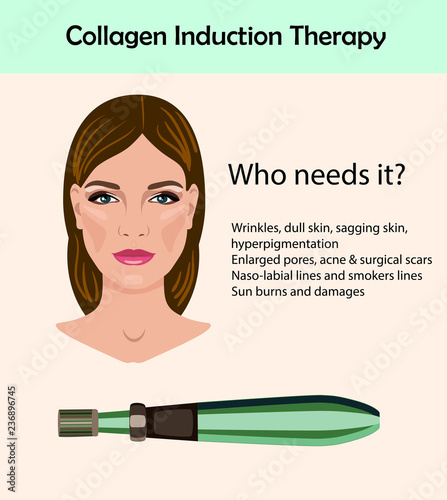 dermapen. Microneedle stamping device isolated. Collagen induction therapy photo