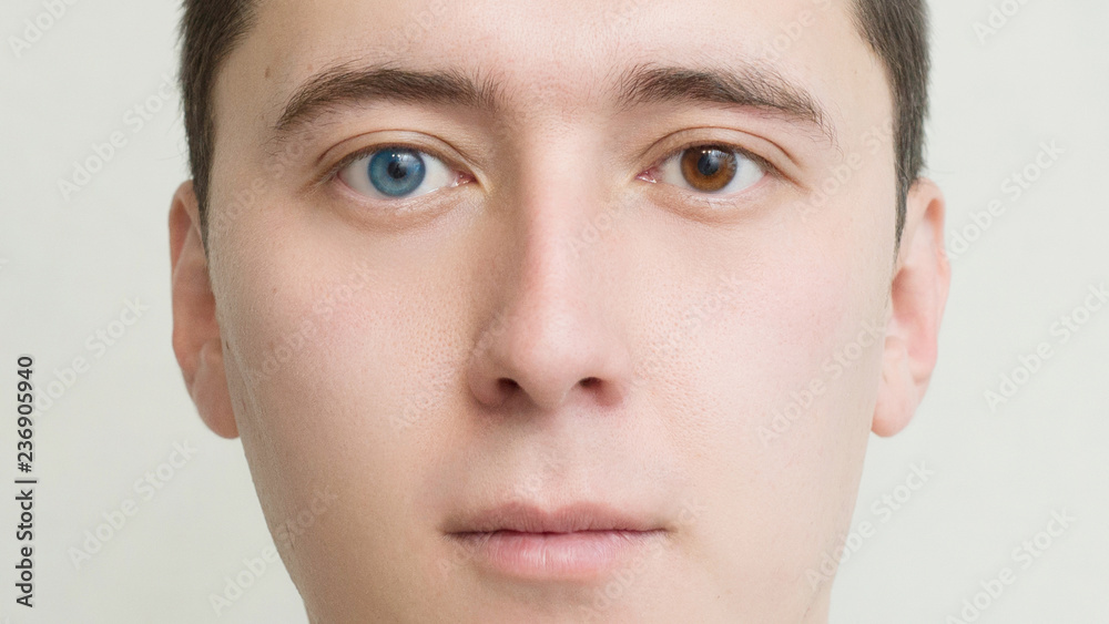 People with two different colored eyes deals