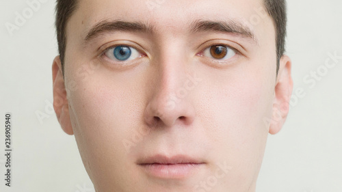 Young man with heterochromia - two different colored eyes. Contact lenses.face close-up  photo