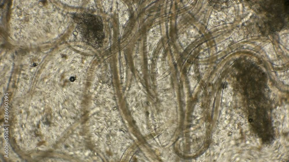 nematode-worm-colony-which-is-used-to-feed-fish-fry-under-a