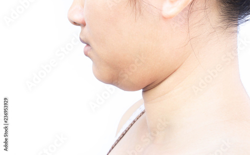 Quadro em tela Closeup woman fat on second chin, health care and beauty concept