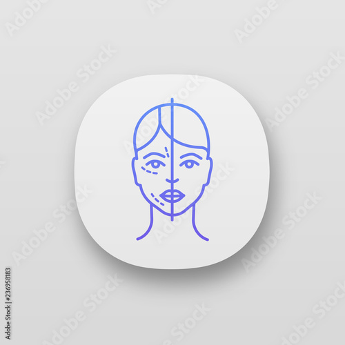 Before and after neurotoxin injection app icon