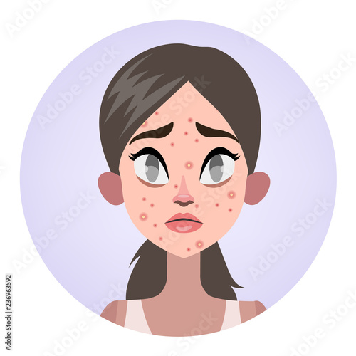 Sad woman with acne on the face