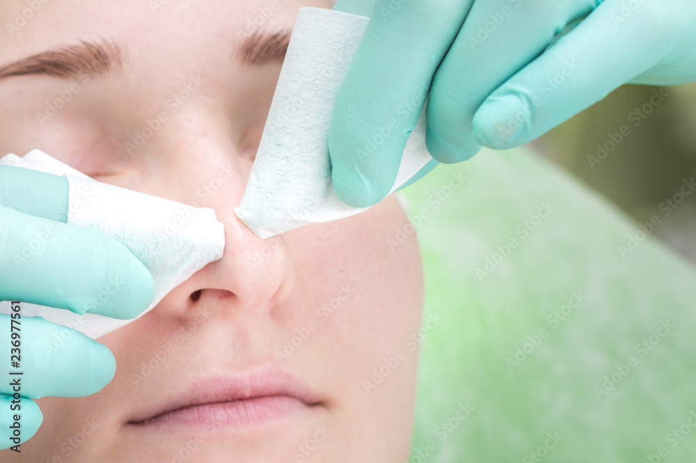 Beautician hands cleans black dots on the nose. Close-up Beautician hands cleans black dots on the nose. Close-up