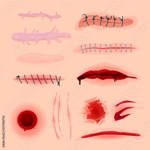 Skin scars, cuts and bloody wounds set