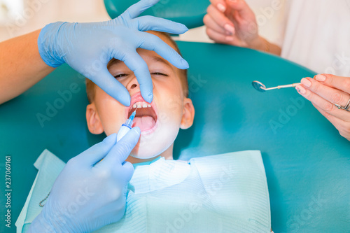 Dentist is treating a boy's teeth.Children's dentistry, Pediatric Dentistry. A female stomatologist is treating teeth of a school-age boy. Oral health and hygiene