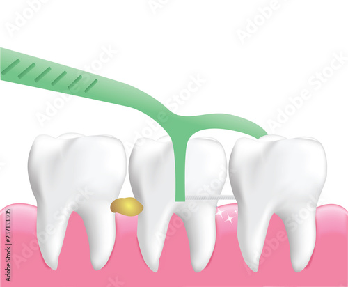 Dental Floss Picks, Dental Cleaning Tool isolated on white background, Realistic design illustration Vector.