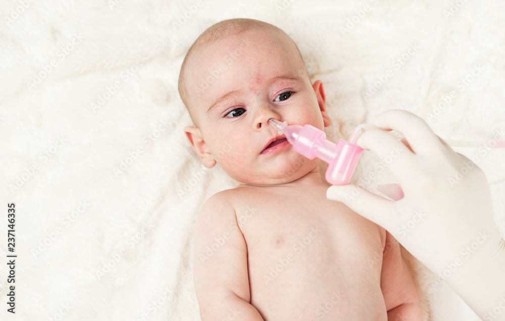 Sick little baby with runny nose and doctor uses a sucking sucker. Sick little baby with runny nose and doctor uses a sucking sucker.