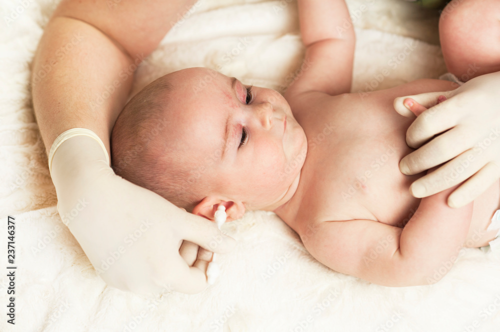 The child at the doctor's office and his ears are cleaned with a cotton swab. The child at the doctor's office and his ears are cleaned with a cotton swab.