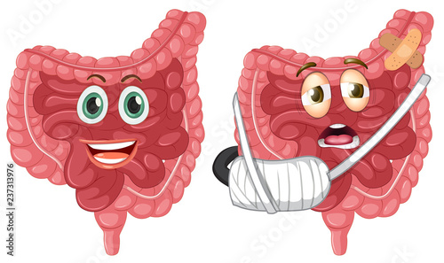Set of healthy and injured intestine