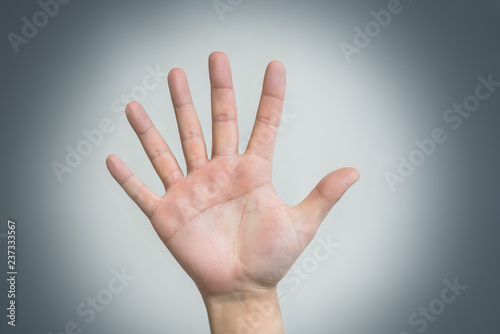 Foto hand with six fingers, human mutation, not like everyone else, strange man, evolution