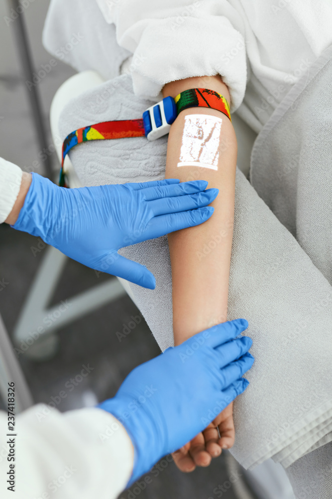 Obraz premium Vein Scanning. Patient Hand With Veins Mapping Closeup