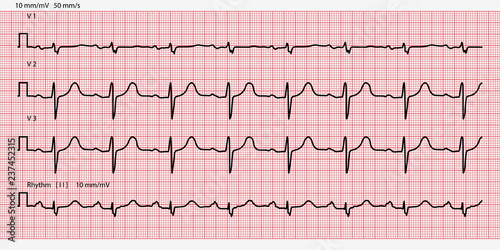 Electrocardiogram paper texture, millimeter paper texture. Vector illustration.