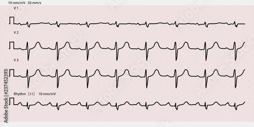 Electrocardiogram paper texture, millimeter paper texture. Vector illustration.
