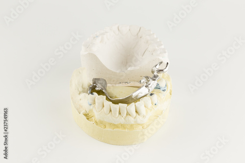 basis of the clasp prosthesis on the gypsum model photo