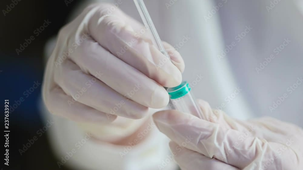 The hands of the doctor in gloves remove the healed cap from the needle of the syringe The hands of the doctor in gloves remove the healed cap from the needle of the syringe