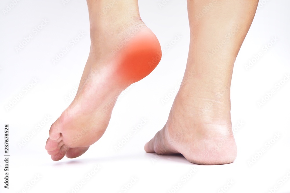 Heel pain , Tendon inflammation , Plantar fasciitis. Heel pain , Tendon inflammation , Plantar fasciitis.