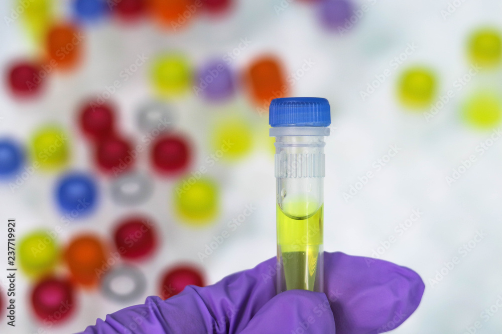 Tubes with ingredients necessary for real time PCR Tubes with ingredients necessary for real time PCR