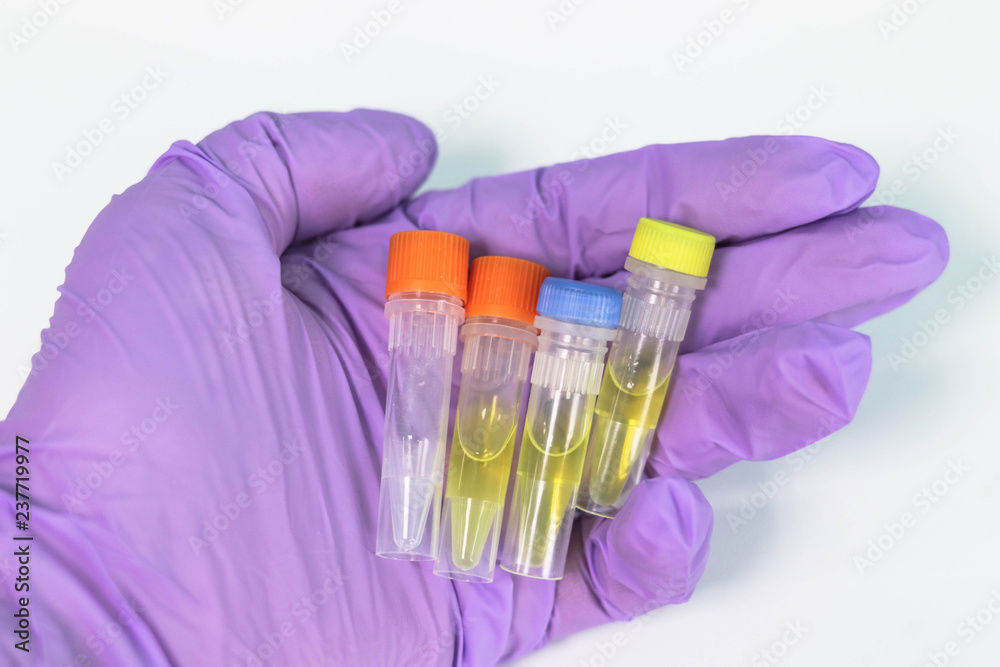 Tubes in the PCR laboratory. In vitro reagents for PCR analysis for