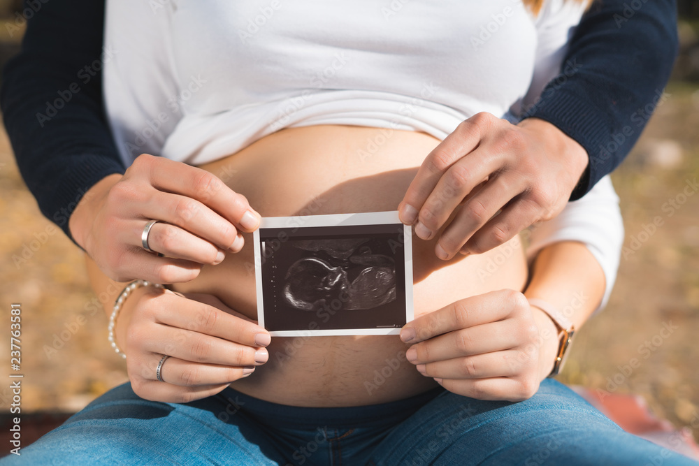 Close up of pregnant woman and her husband holding ultrasound scan on her tummy Close up of pregnant woman and her husband holding ultrasound scan on her tummy