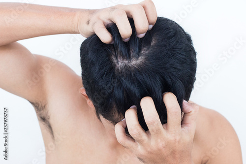 Young man suffering from itching her head, Itching scalp.