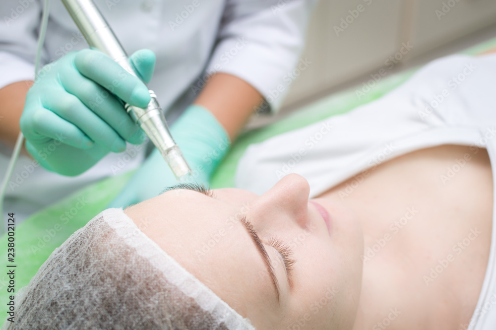 Beautician makes microneedling young girl in the beauty salon close-up mezo roller Beautician makes microneedling young girl in the beauty salon close-up mezo roller