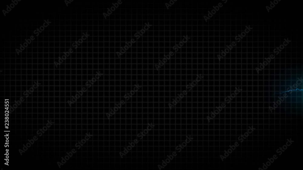 Sick and healthy heart. A healthy cardiogram, then an unhealthy cardiogram. 36 Sick and healthy heart. A healthy cardiogram, then an unhealthy cardiogram. 36