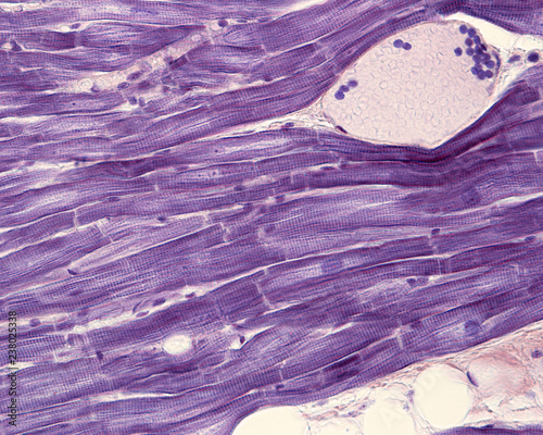 Canvas Print Myocardium. Cardiac muscle cells