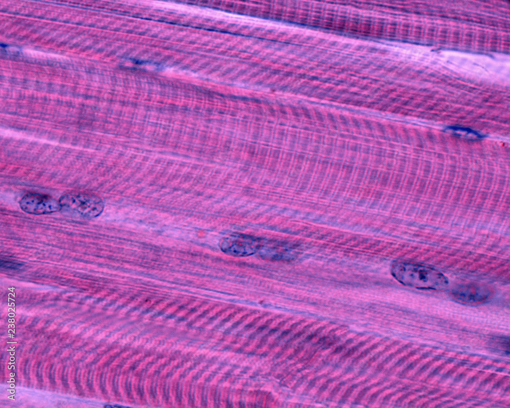 Ταπετσαρία Striated skeletal muscle fibers