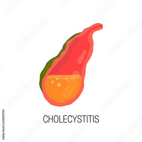 Inflamed gallbladder, vector concept of cholecystitis