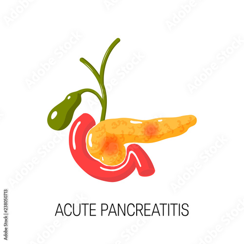 Acute pancreatitis concept. Vector illustration photo