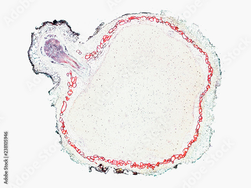 Bilde på lerret rhizobium soybean root with unattached nodule - cross section cut under the micr