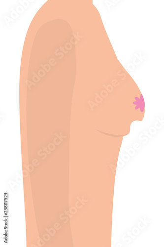 Breast cancer sign