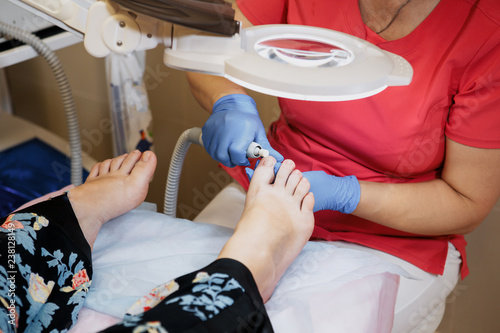 Podology treatment. Podiatrist treating toenail fungus. Doctor removes calluses, corns and treats ingrown nail. Hardware manicure. Health, body care concept. Selective focus. photo