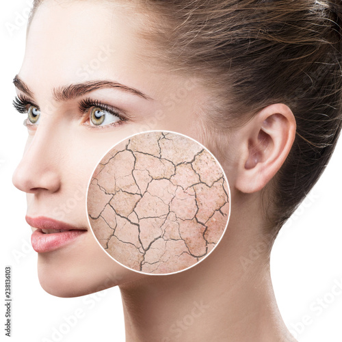 Zoom circle shows dry facial skin before moistening.