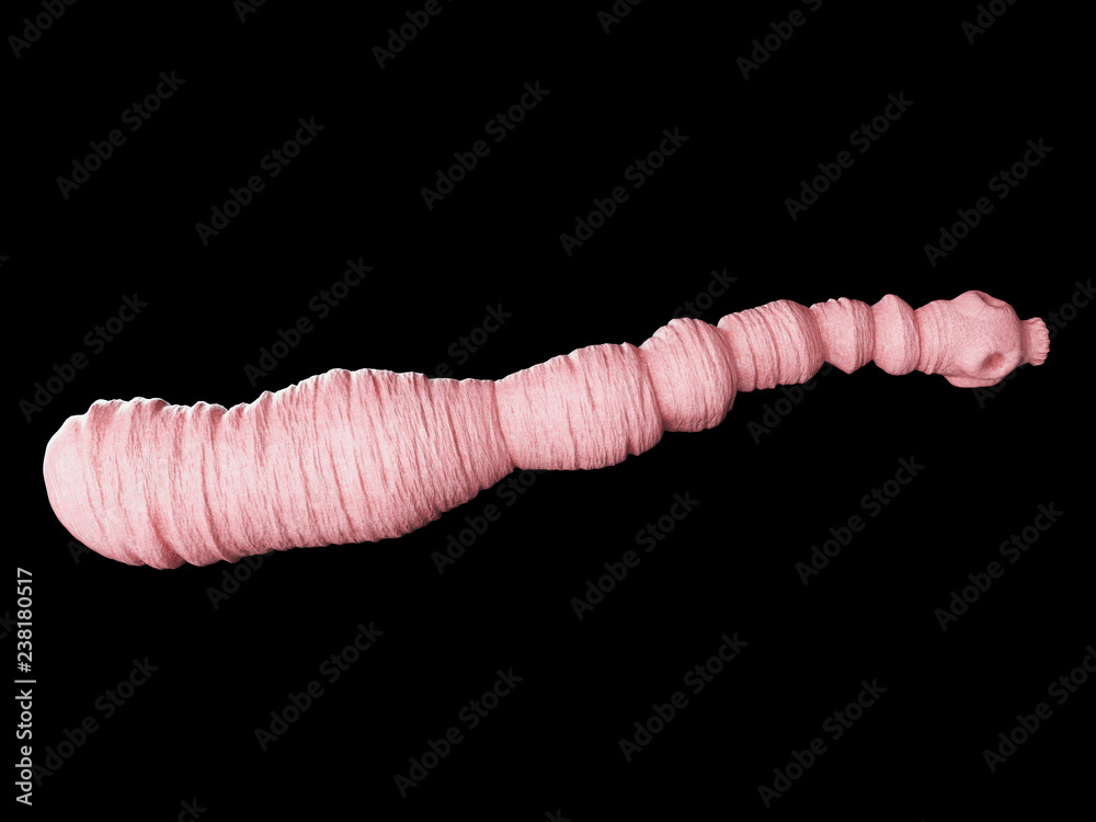 3d rendered medically accurate illustration of an echinococcus ...
