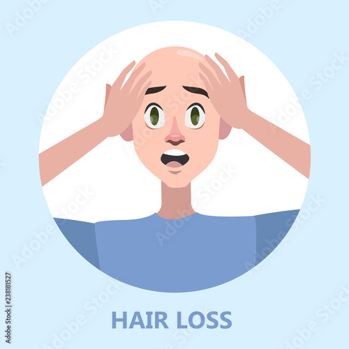 Hair loss problem. Stressed man with alopecia
