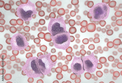 3d illustration of the strong increase of non-functional white blood cells called leukemia cells leading to blood cancer disease