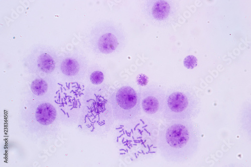Chromosomes Human under the microscope for education.