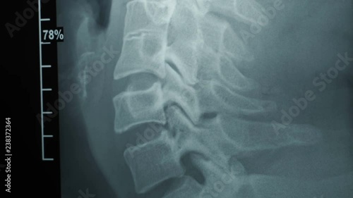 Dolly shot of x-ray image