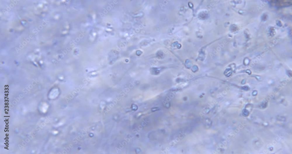 chaotic movement of cells under a microscope