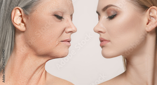Comparison. Portrait of beautiful woman with problem and clean skin, aging and youth concept, beauty treatment and lifting. Before and after concept. Youth, old age. Process of aging and rejuvenation