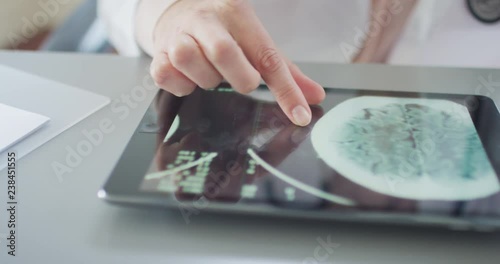 Doctor Analyzing Brain CT Scan On Digital Tablet 4K
