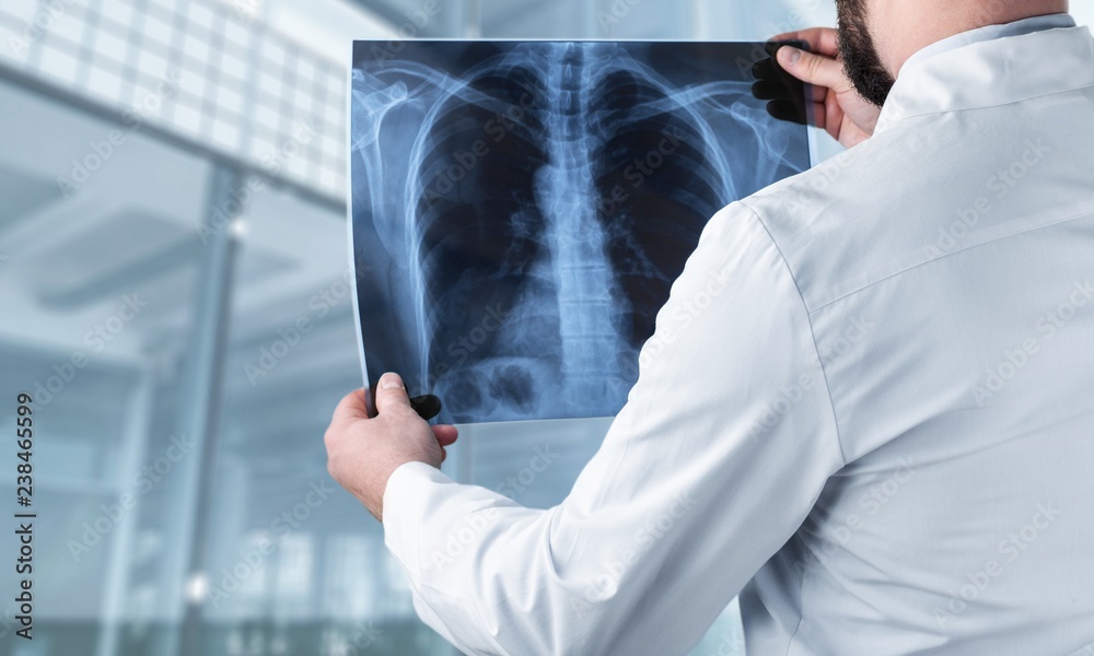 © BillionPhotos.com - Xray radiology doctor hospital disease radiography ray © BillionPhotos.com - Xray radiology doctor hospital disease radiography ray