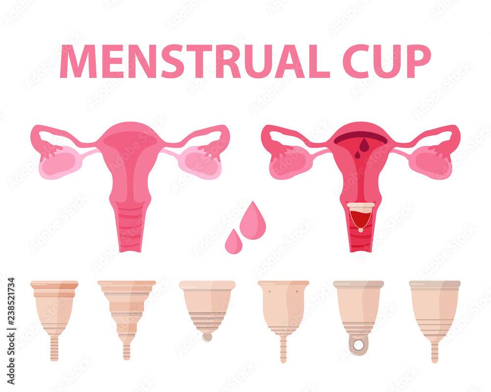 Collection of menstrual cups. Illustration of use of menstrual cup