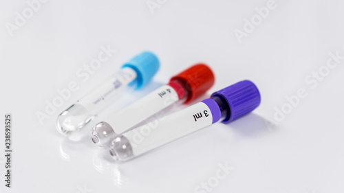 Three bottles for samples used in hospitals or medicine for blood samples, in a laboratory on the white background