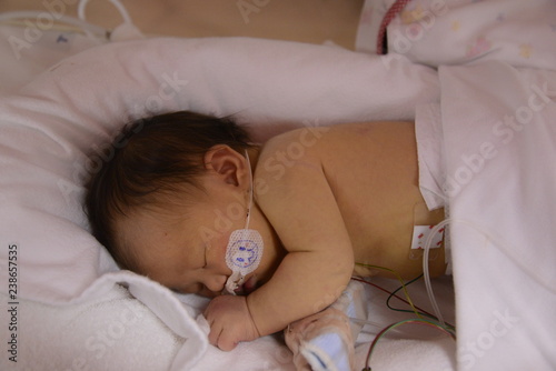 NICU BABY photo