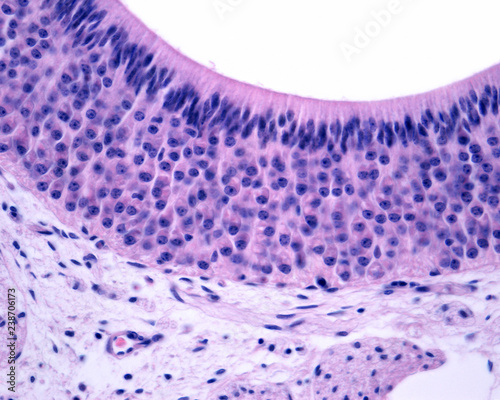 Vomeronasal organ photo