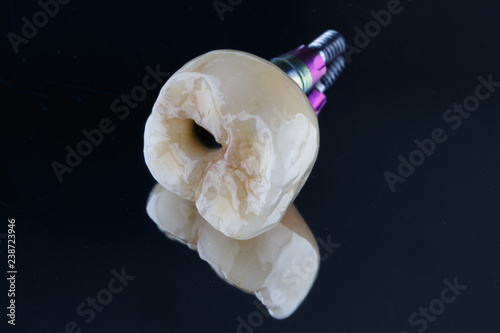 ceramic crown on a tooth chewing in complete